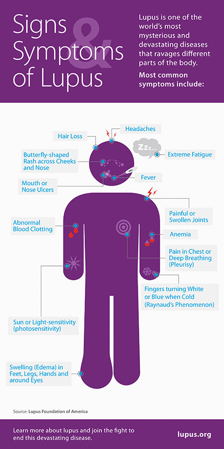 Signs_and_Symptoms Lupus